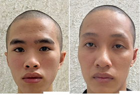 Cơ quan CSĐT- Công an huyện Thủy Nguyên: Khởi tố vụ án, khởi tố bị can 2 đối tượng về hành vi “Mua bán trái phép chất ma túy”