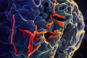 Bệnh viện CATP: Thông tin và khuyến cáo các biện pháp phòng, chống bệnh do virus Ebola